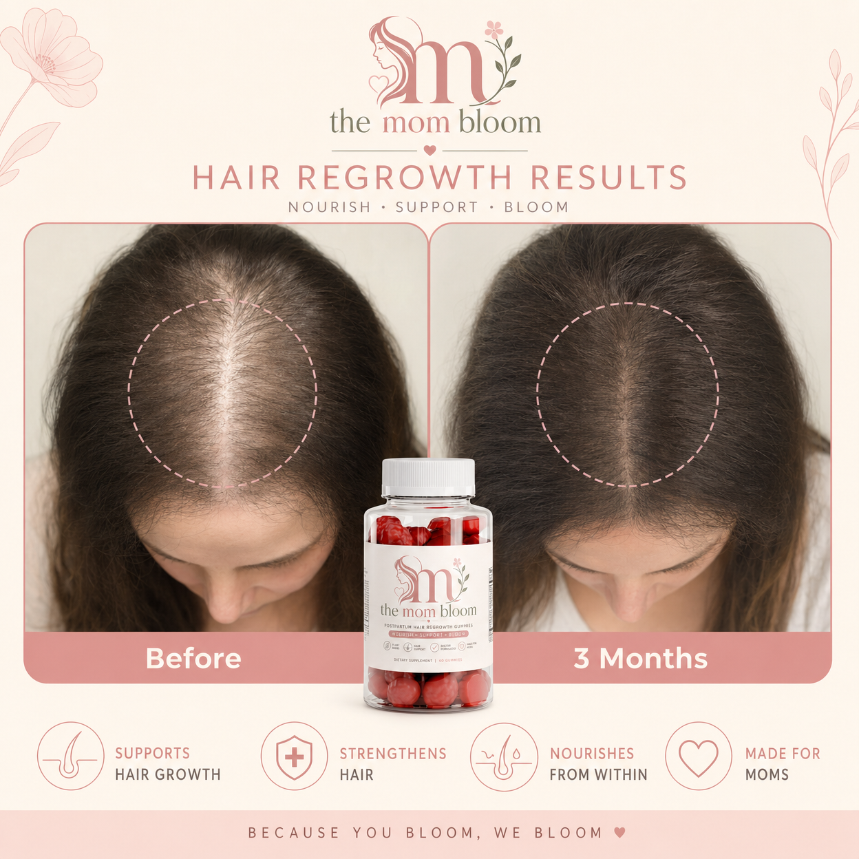 The Bloom Glow® Post Partum Hair Regrowth Gummies